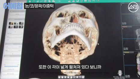 에이비성형외과 관련 이미지 3