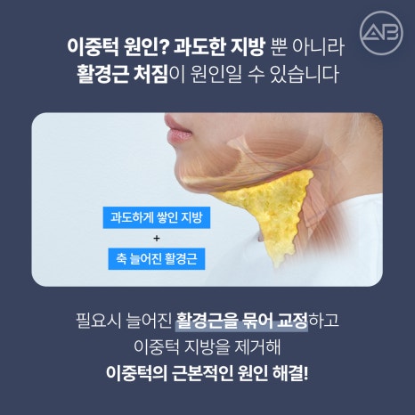 The Secret to a Slim Jawline, AB Plastic Surgery Double Chin Muscle Binding image 4
