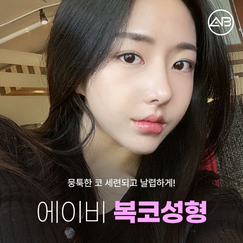 Why AB Plastic Surgery Is Famous for Bulbous Nose Surgery image 1