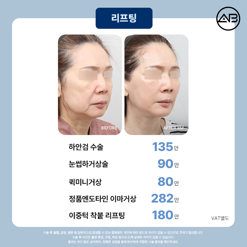 AB Plastic Surgery 49% Winter Limited Event image 13