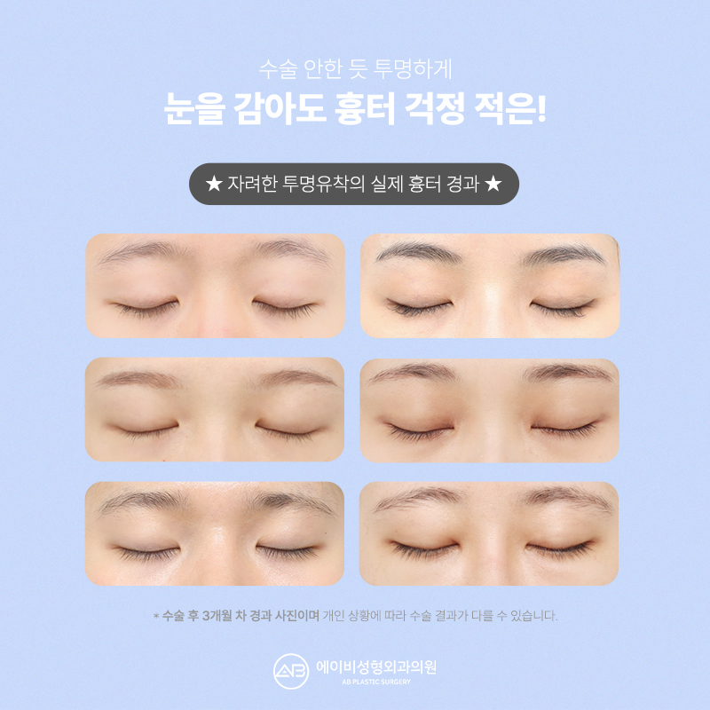 If You Want Elegant Eyes, AB’s Elegant Transparent Adhesion image 4
