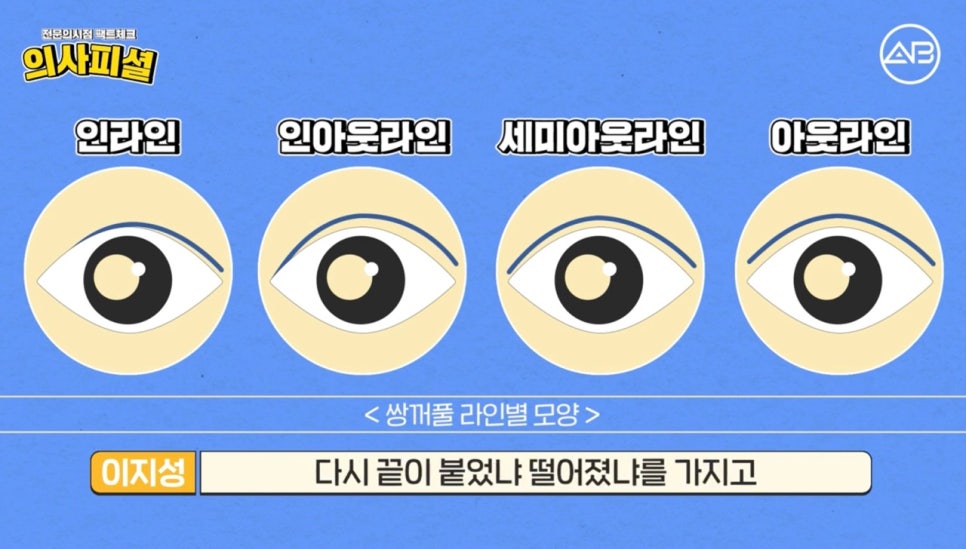 #에이비성형외과#에이비TV#눈성형#첫눈수술 관련 이미지 9