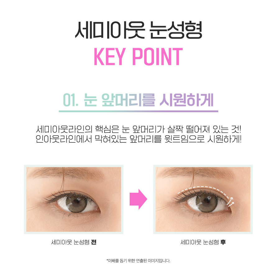 세미아웃눈성형 차이가 있어 관련 이미지 2