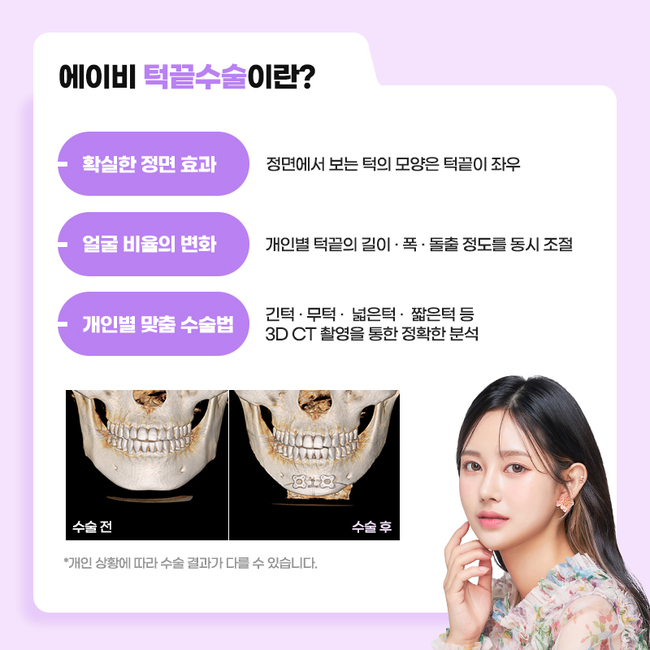 AB Plastic Surgery Clinic with Three Types of Facial Contouring, Different in Detail image 4