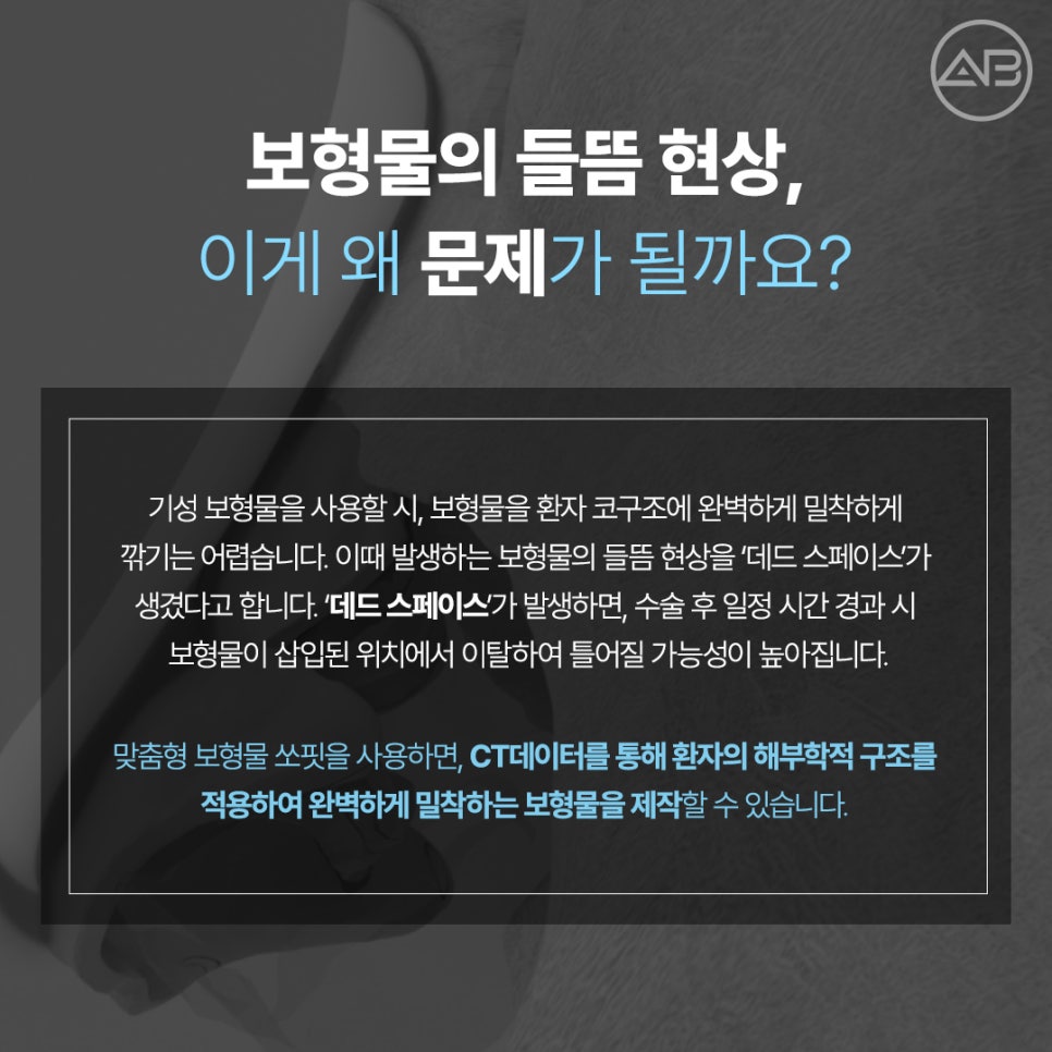 에이비성형외과 쏘핏 (SOFIT) 3D 코성형보형물 비대칭 매부리 개선 관련 이미지 8