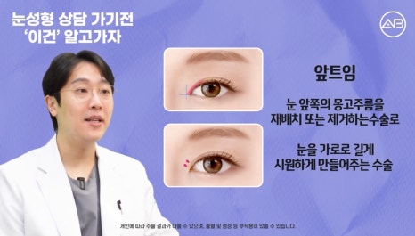 #AB Plastic Surgery #AB TV #Eye Surgery #Eye Surgery Terminology image 9