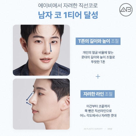 남자직선코성형, 남성적인 이미지 원한다면 에이비성형외과 관련 이미지 3