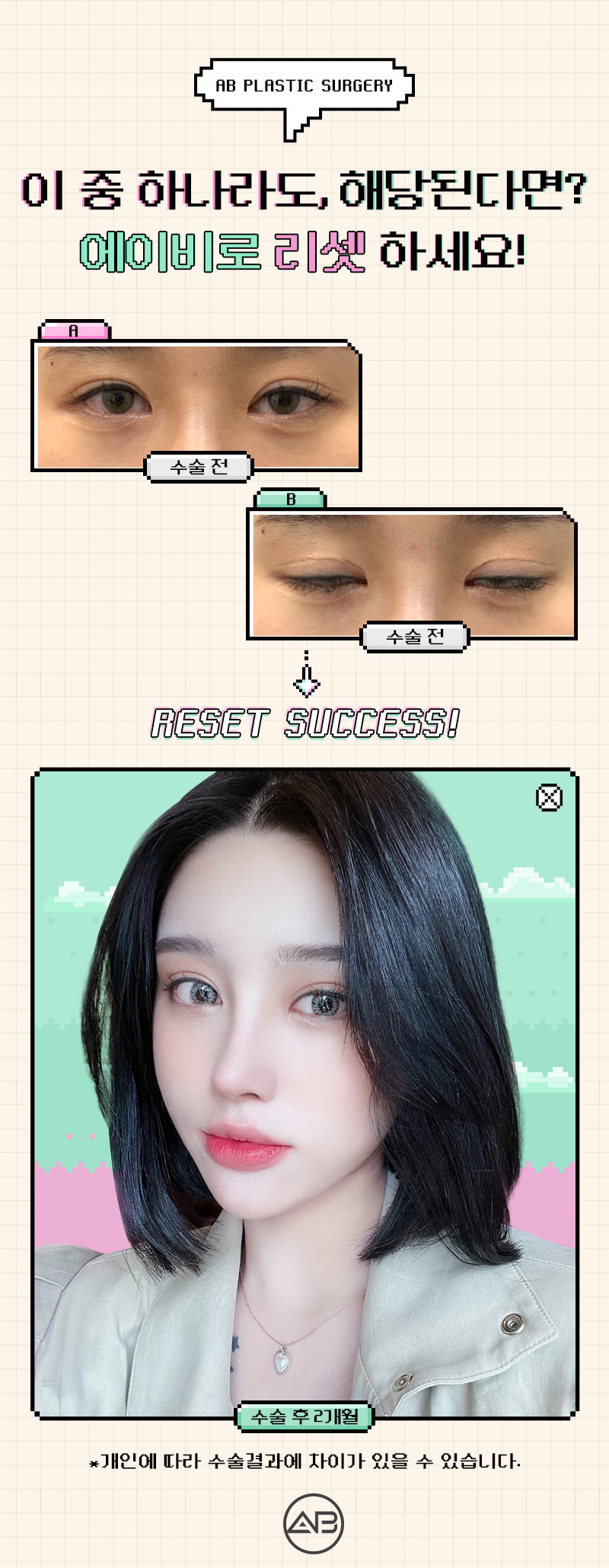 Still 고민ing About Double Eyelid Revision Surgery Cost? image 6