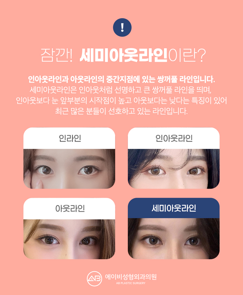 요즘 대세 세미아웃 눈성형 성공하려면? 관련 이미지 3