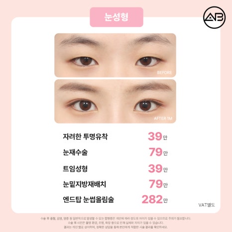 에이비성형외과 설렘 가득 봄 한정 49% 할인 이벤트 관련 이미지 7