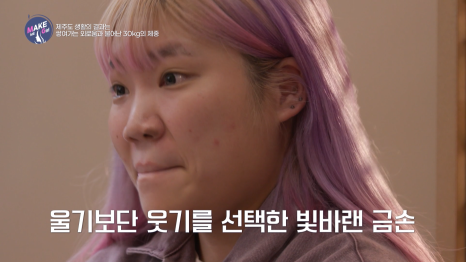 맥미걸 (MAKEMEGirl) 빛바랜금손, 자연스럽게 개선한 복코성형 리얼 후기 관련 이미지 3