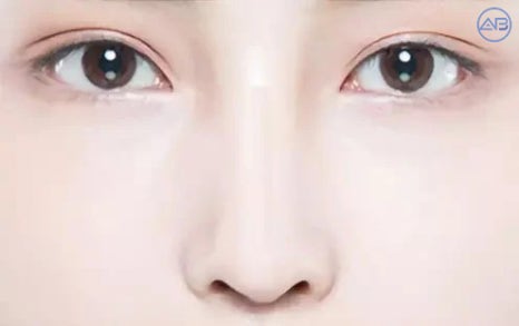 에이비성형외과 코성형 잘되는 코, 따로 있을까? 관련 이미지 4