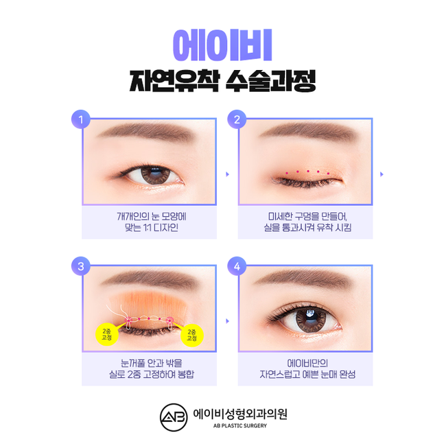 AB Plastic Surgery Natural Adhesion Review image 3
