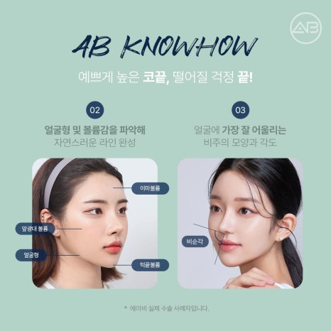 자려한코성형 원한다면 에이비성형외과 관련 이미지 7