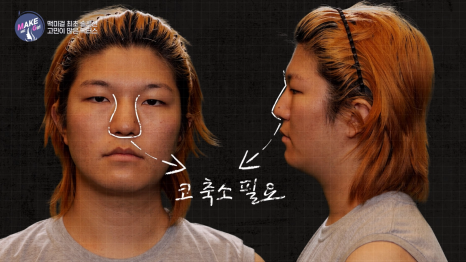 에이비성형외과 X 맥미걸(MAKEMEGirl) 9회 리얼맥미걸 방송리뷰 관련 이미지 7