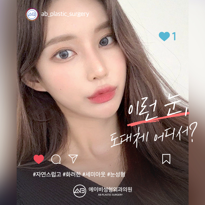 요즘 대세 세미아웃 눈성형 성공하려면? 관련 이미지 2