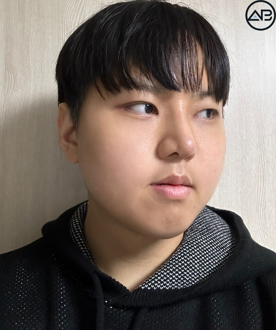 에이비성형외과 맥미남(MAKE미남) 방송이후 근황_가슴앓이내남자 관련 이미지 6