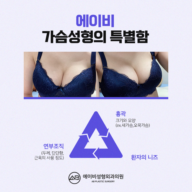 Concerned About Breast Surgery Cost? image 4