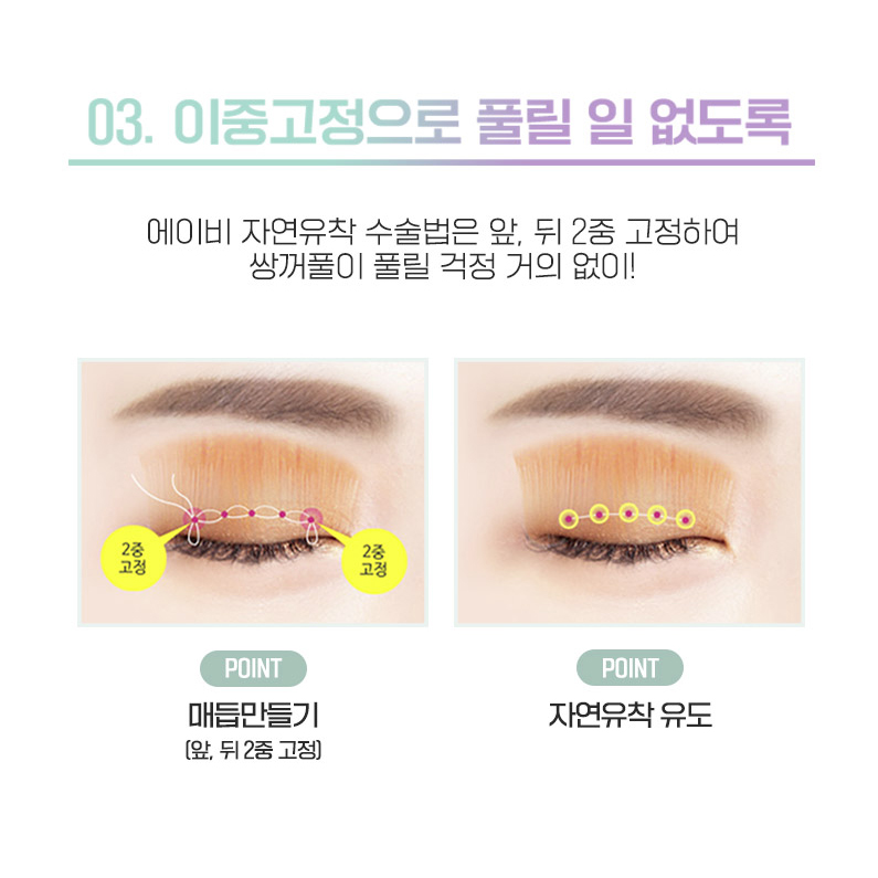 세미아웃눈성형 차이가 있어 관련 이미지 4