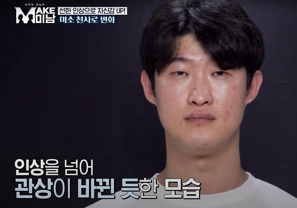 에이비성형외과 맥미남(MAKE미남) 4회 - 도깨비내남자 코수술 알아보기! 관련 이미지 4