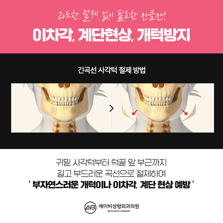 Trust AB Plastic Surgery, the Best Place for Square Jaw Surgery image 4