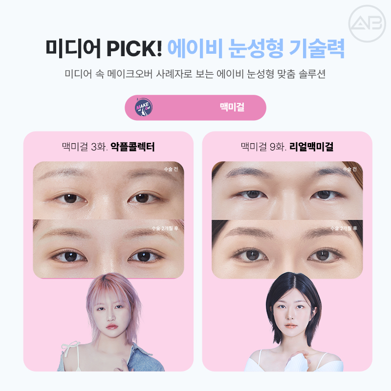 Transparent Adhesion for a Refined Look: AB Plastic Surgery for Attractive Eyes image 11
