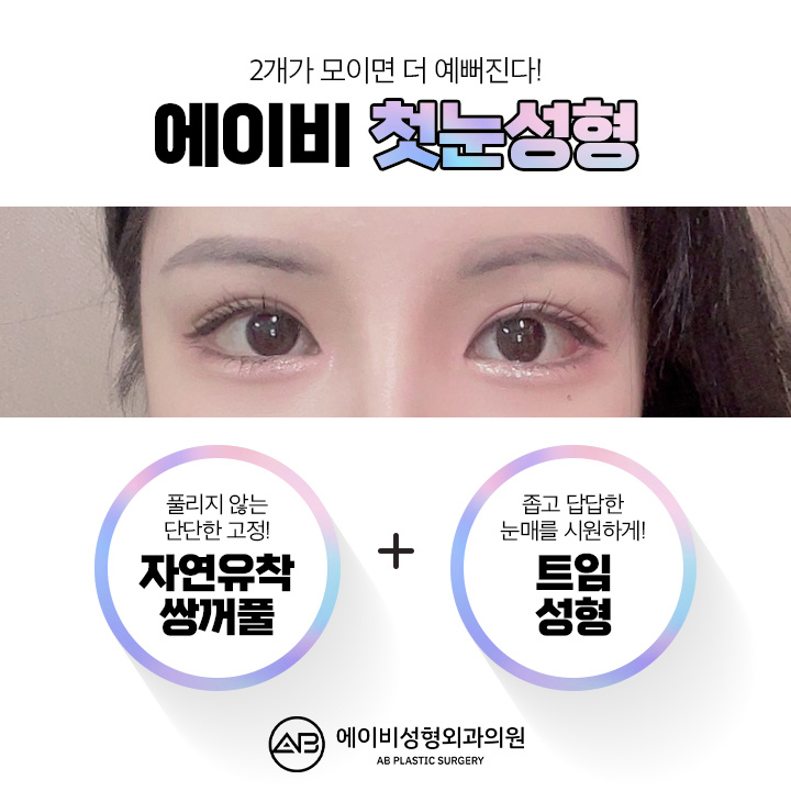 쌍꺼풀수술전후 새로운 결과를 관련 이미지 5