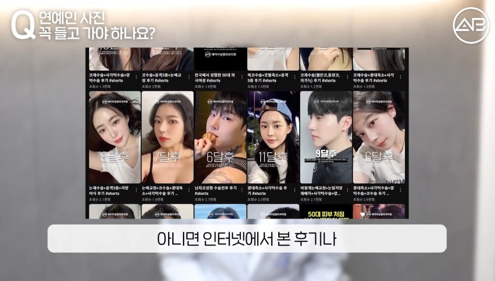#AB Plastic Surgery #AB TV #Nose Surgery #First Nose Surgery image 14