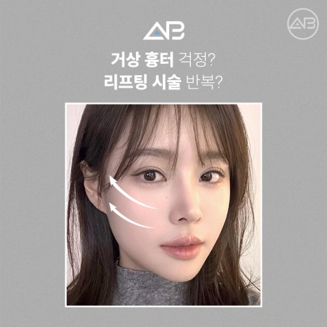 The Secret to Looking 10 Years Younger: AB Plastic Surgery Quick Mini Lift image 2