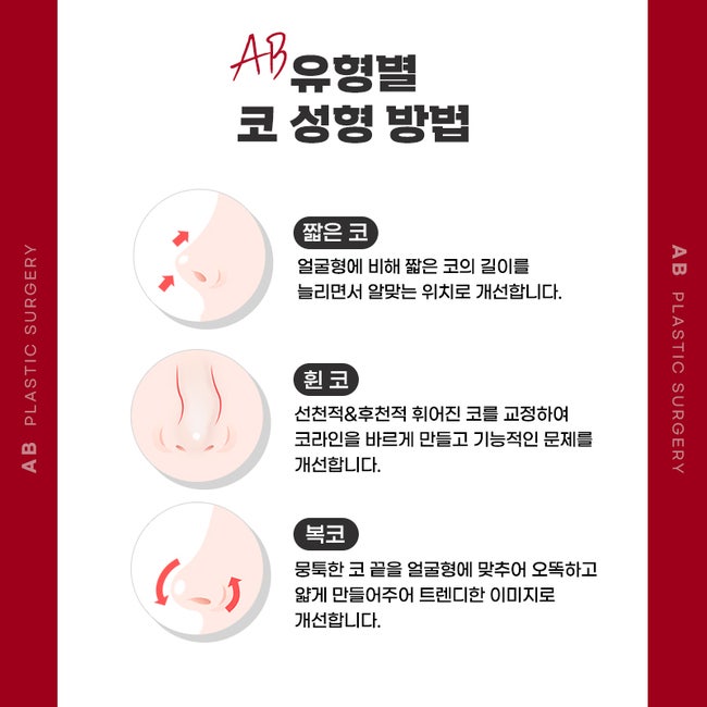 코수술후기 많은 에이비성형외과 관련 이미지 2