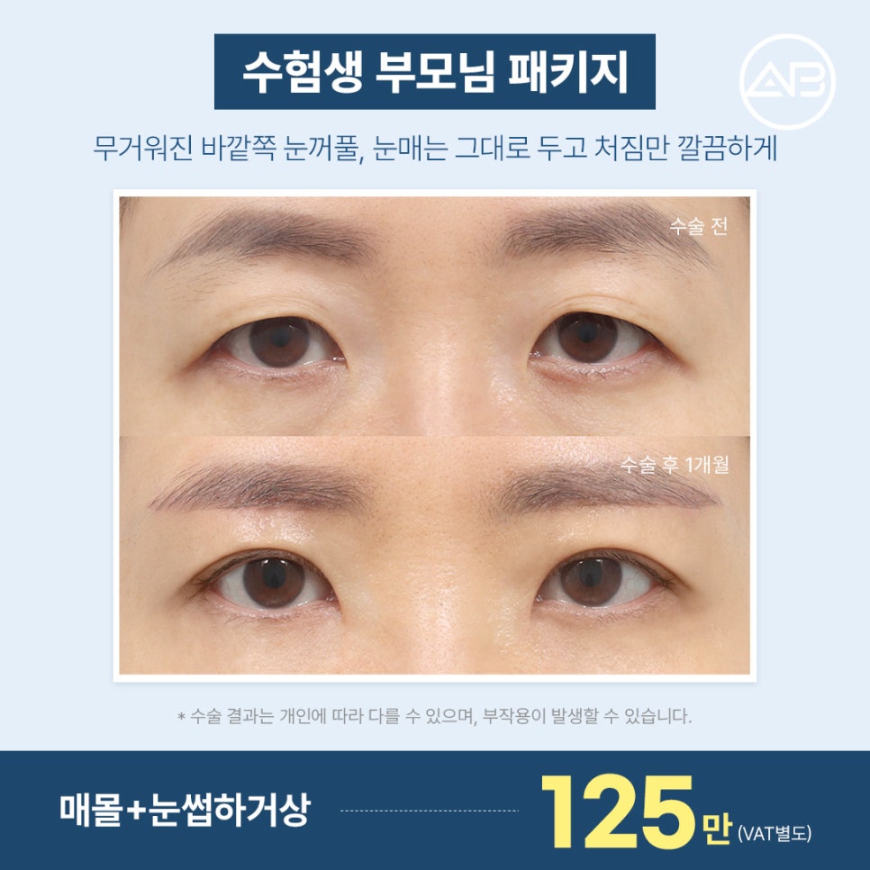 에이비성형외과 수능 끝! 2027 수험생 특별 이벤트 관련 이미지 5