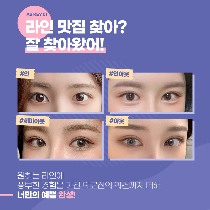 자연유착쌍꺼풀후기 왜 인기일까? 관련 이미지 4