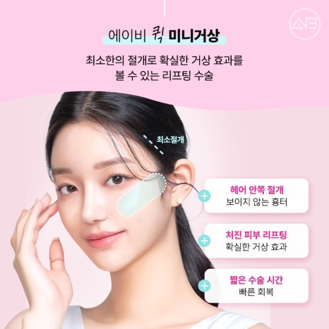 The Secret to Looking 10 Years Younger: AB Plastic Surgery Quick Mini Lift image 4