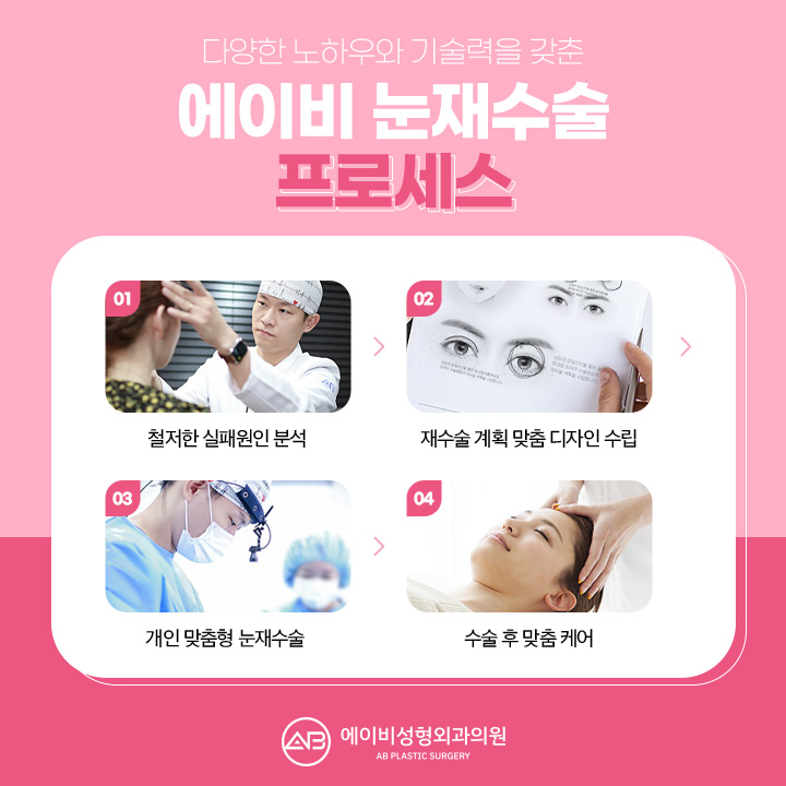 눈재수술유명한곳 하면 에이비성형외과 아닐까 관련 이미지 2
