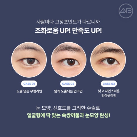 인상을 바꾸는 첫 시작, 에이비성형외과 남자눈성형 관련 이미지 7