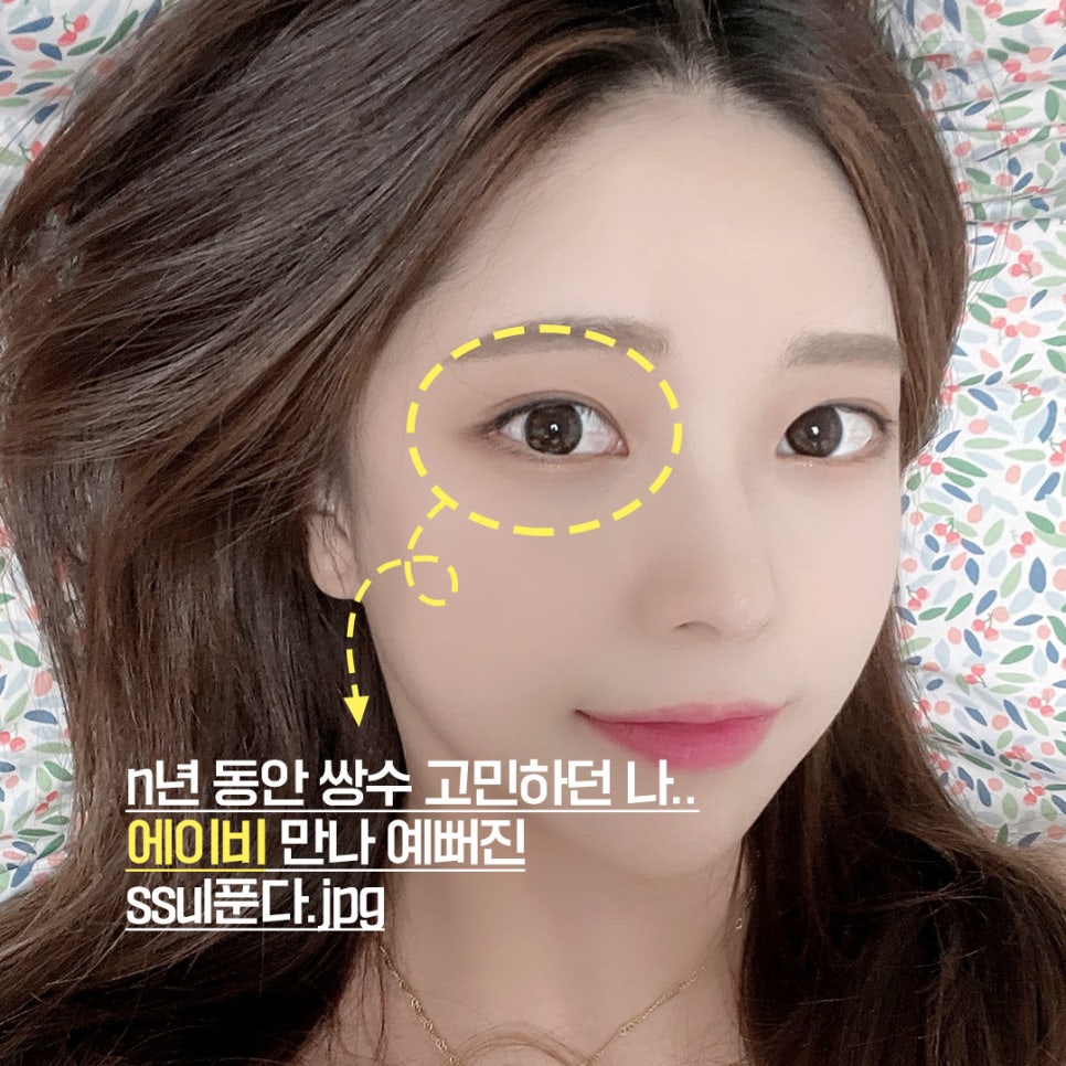 [칼럼] 눈성형 수술법 중 절개법은 부자연스러운가? 관련 이미지 1