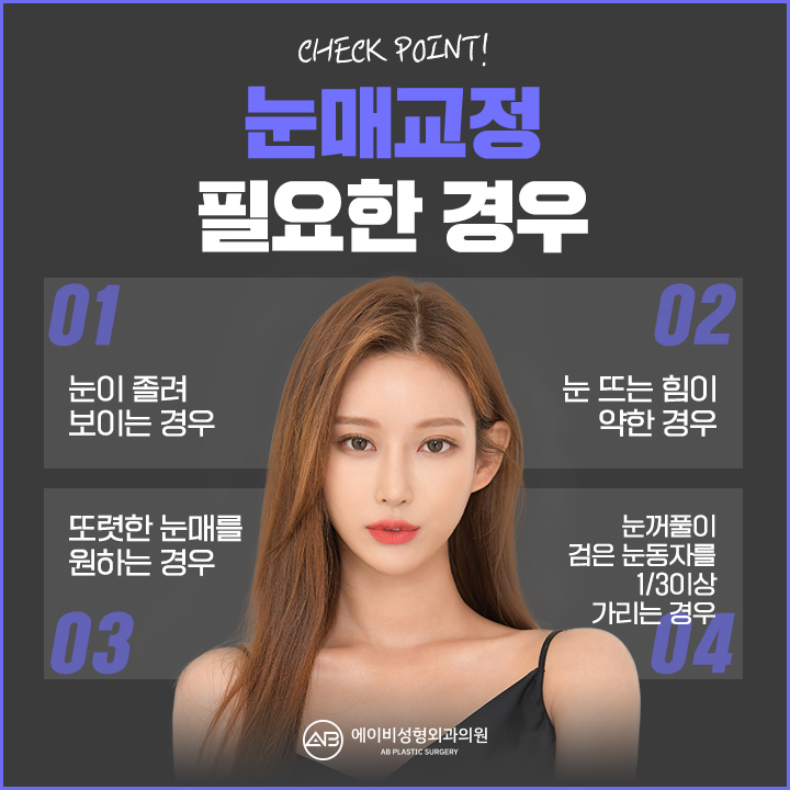 눈매교정수술전후 비교해보면 달라 관련 이미지 3