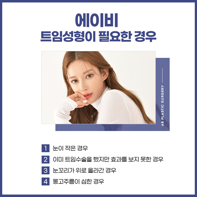 앞트임전후 달라짐을 느껴봐 관련 이미지 4