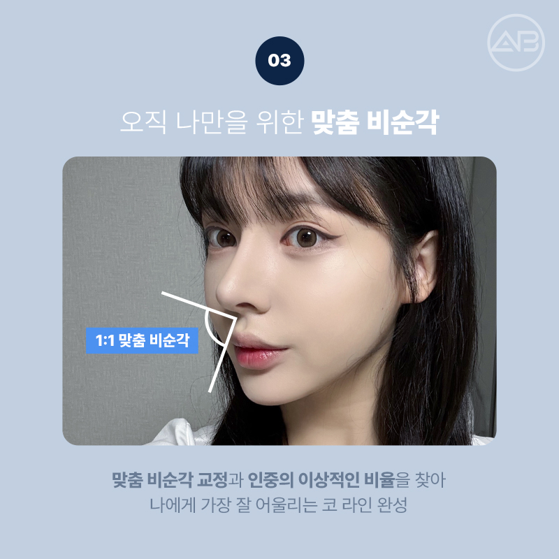 에이비성형외과 자려한코성형 비주라인개선 후기 관련 이미지 5