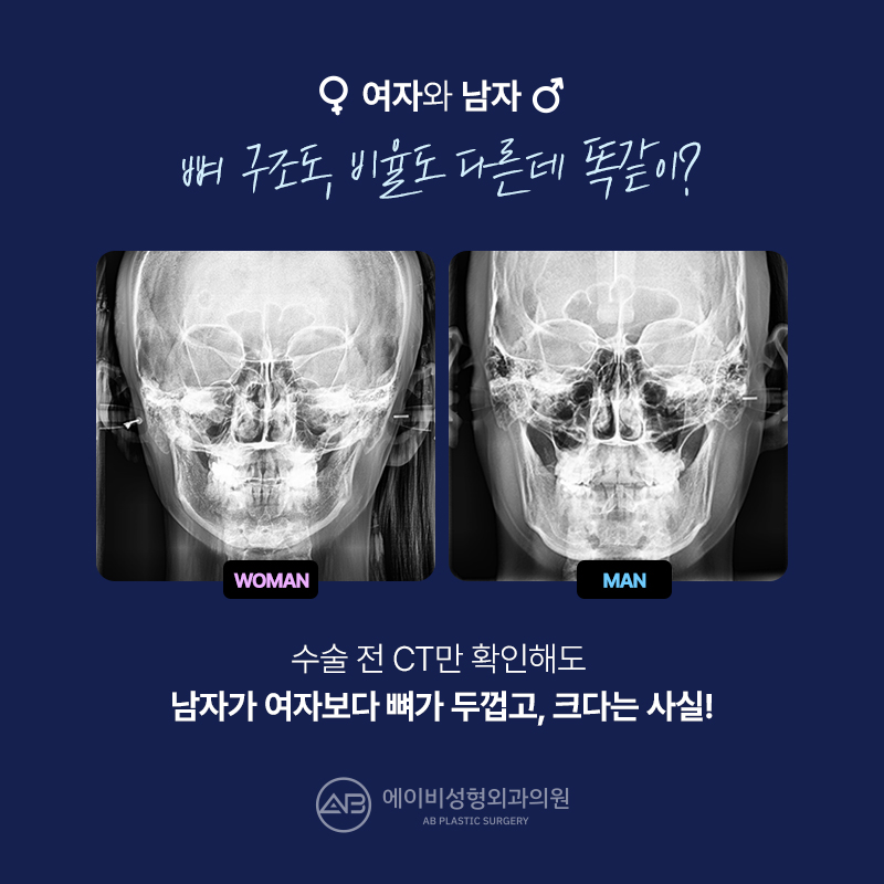 남자 윤곽수술잘하는곳 볼 때 고려해야 할 점 관련 이미지 2