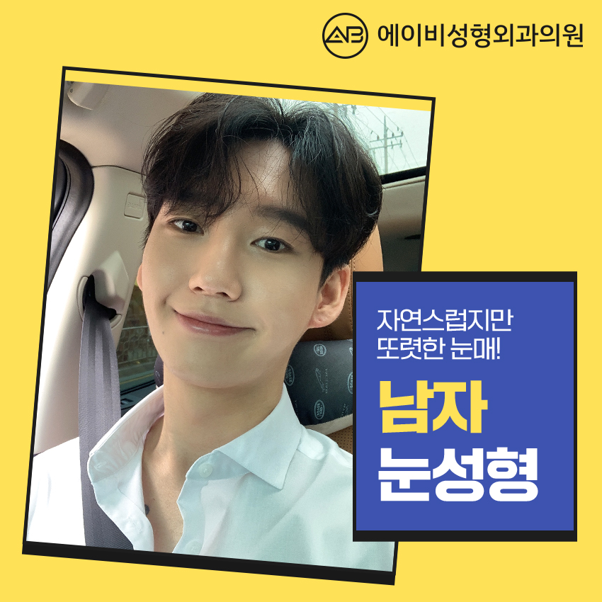 남자눈성형전후 차원이 달라 관련 이미지 3