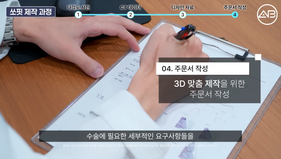 에이비성형외과 맞춤보형물 쏘핏 보형물이 중요한 이유 관련 이미지 6