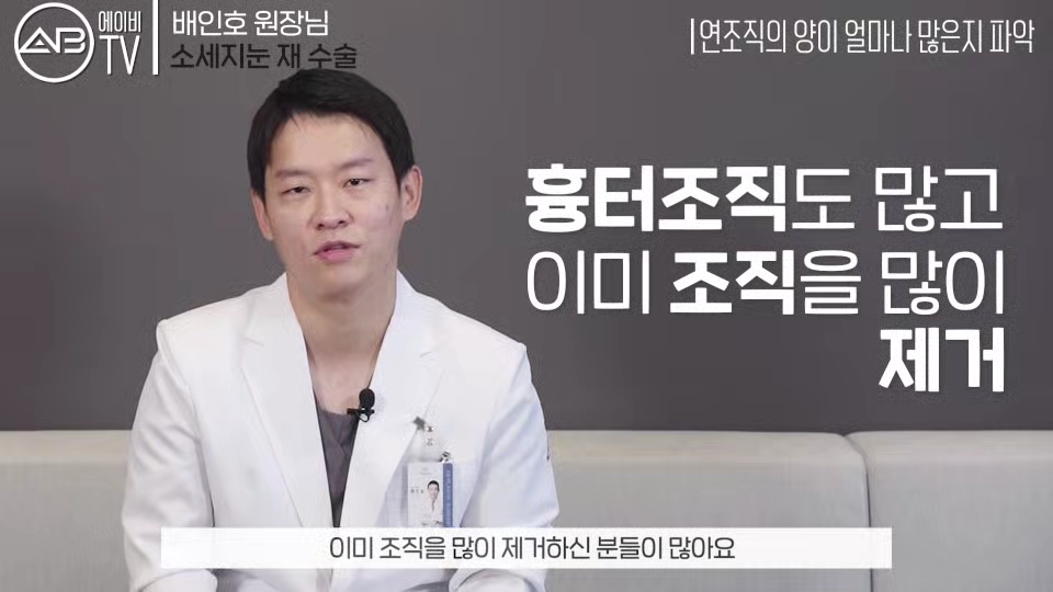 에이비성형외과 #유튜브 #에이비TV #소세지눈 #눈재수술 #소세지눈재수술 관련 이미지 3