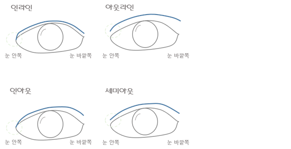 Q. 첫눈수술인데 세미아웃 인아웃의 차이점이 뭔가요? 관련 이미지 1