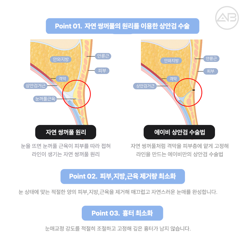 PRS KOREA 2024 : 에이비성형외과의 발표 내용과 성과 관련 이미지 12