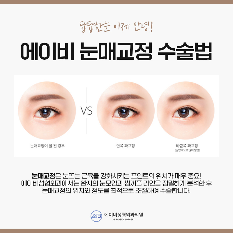 안검하수수술 부담없이 관련 이미지 6