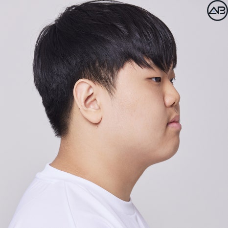 에이비성형외과 맥미남(MAKE미남) 방송이후 근황_가슴앓이내남자 관련 이미지 10