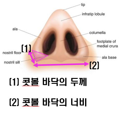 Q. Nose tip surgery, alar reduction, and bulbous nose surgery all look similar. Are they different surgeries? image 3