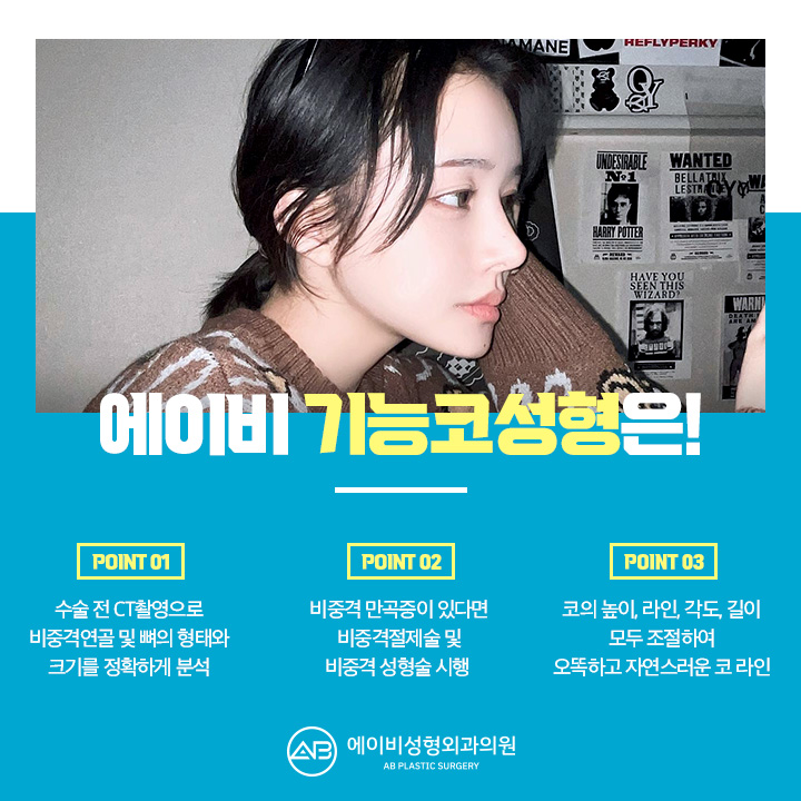 비염코성형실비 어떻게 할까? 관련 이미지 2