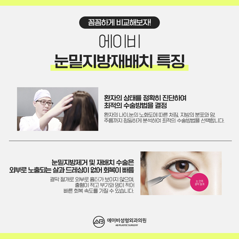 눈밑지방재배치수술 제대로 알고하자 관련 이미지 5